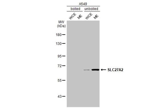 Western Blot: FATP2/SLC27A2 Antibody (HL2232) - Azide and BSA Free [NBP3-25687] - Boiled and unboiled A549 whole cell and membrane extracts (30 ug) were separated by 7.5% SDS-PAGE, and the membrane was blotted with SLC27A2 antibody [HL2232] (NBP3-25687) diluted at 1:1000. The HRP-conjugated anti-rabbit IgG antibody was used to detect the primary antibody. (WCE: whole cell extract; ME: membrane extract)