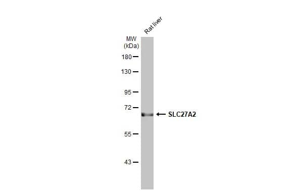 Western Blot: FATP2/SLC27A2 Antibody (HL2232) - Azide and BSA Free [NBP3-25687] - Rat tissue extract (50 ug) was separated by 7.5% SDS-PAGE, and the membrane was blotted with SLC27A2 antibody [HL2232] (NBP3-25687) diluted at 1:1000. The HRP-conjugated anti-rabbit IgG antibody was used to detect the primary antibody.