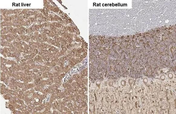 Immunohistochemistry-Paraffin: FATP2/SLC27A2 Antibody (HL2232) - Azide and BSA Free [NBP3-25687] - SLC27A2 antibody [HL2232] detects SLC27A2 protein by immunohistochemical analysis. Sample: Paraffin-embedded rat tissues. SLC27A2 stained by SLC27A2 antibody [HL2232] (NBP3-25687) diluted at 1:100. Antigen Retrieval: Citrate buffer, pH 6.0, 15 min