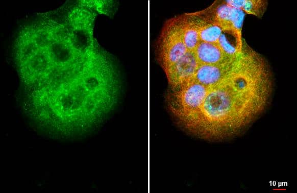 SMYD3 antibody [HL2464] detects SMYD3 protein by immunofluorescent analysis.Sample: MCF-7 cells were fixed in 4% paraformaldehyde at RT for 15 min.Green: SMYD3 stained by SMYD3 antibody [HL2464] (NBP3-25688) diluted at 1:500.Red: alpha Tubulin, a cytoskeleton marker, stained by alpha Tubulin antibody [GT114] diluted at 1:1000.Blue: Fluoroshield with DAPI . 