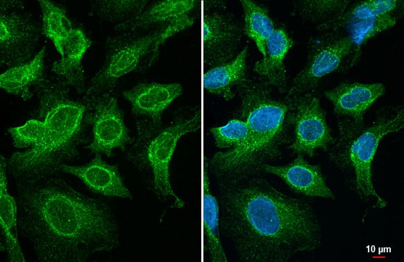 Immunocytochemistry/ Immunofluorescence SNX5 Antibody (HL2375) - Azide and BSA Free