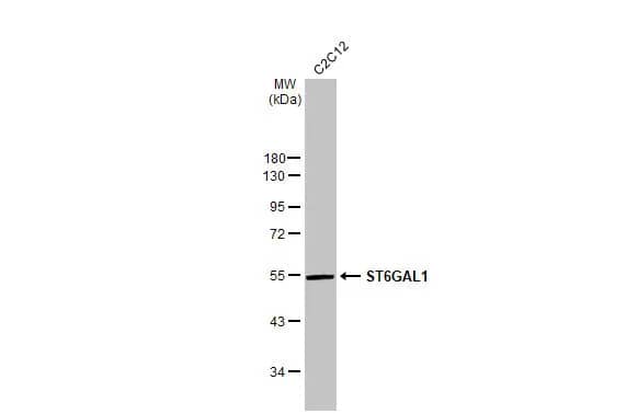 Western Blot: ST6 Gal Sialyltransferase 1/ST6GAL1/CD75 Antibody (HL2318) - Azide and BSA Free [NBP3-25695] - Whole cell extract (30 ug) was separated by 10% SDS-PAGE, and the membrane was blotted with ST6GAL1 antibody [HL2318] (NBP3-25695) diluted at 1:1000. The HRP-conjugated anti-rabbit IgG antibody was used to detect the primary antibody.