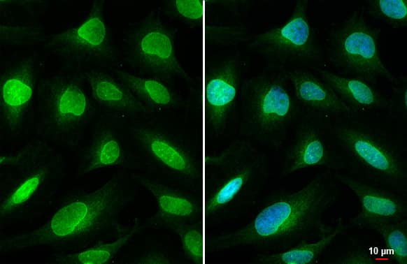 Immunocytochemistry/Immunofluorescence: SUN1 Antibody (HL1946) - Azide and BSA Free [NBP3-25701] - SUN1 antibody [HL1946] detects SUN1 protein at nuclear envelope by immunofluorescent analysis. Sample: HeLa cells were fixed in 4% paraformaldehyde at RT for 15 min. Green: SUN1 stained by SUN1 antibody [HL1946] (NBP3-25701) diluted at 1:500. Blue: Fluoroshield with DAPI .