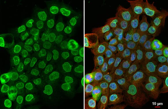 Immunocytochemistry/Immunofluorescence: SUN1 Antibody (HL1946) - Azide and BSA Free [NBP3-25701] - SUN1 antibody [HL1946] detects SUN1 protein at nuclear envelope by immunofluorescent analysis. Sample: A431 cells were fixed in 4% paraformaldehyde at RT for 15 min. Green: SUN1 stained by SUN1 antibody [HL1946] (NBP3-25701) diluted at 1:500. Red: alpha Tubulin, a cytoskeleton marker, stained by alpha Tubulin antibody [GT114] (NBP2-43837) diluted at 1:1000. Blue: Fluoroshield with DAPI .