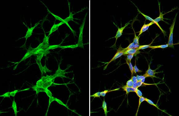 Immunocytochemistry/Immunofluorescence: Synaptotagmin 1 Antibody (HL1626) - Azide and BSA Free [NBP3-25705] - Synaptotagmin 1 antibody [HL1626] detects Synaptotagmin 1 protein by immunofluorescent analysis. Sample: SH-SY-5Y cells were fixed in 4% paraformaldehyde at RT for 15 min. Green: Synaptotagmin 1 stained by Synaptotagmin 1 antibody [HL1626] (NBP3-25705) diluted at 1:500. Red: alpha Tubulin, a cytoskeleton marker, stained by alpha Tubulin antibody [GT114] (NBP2-43837) diluted at 1:1000. Blue: Fluoroshield with DAPI .