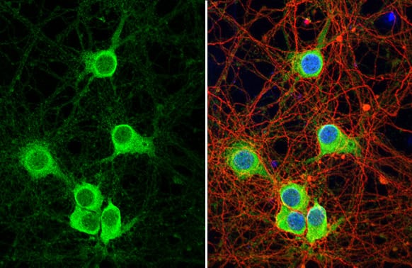 Immunocytochemistry/Immunofluorescence: Synaptotagmin 1 Antibody (HL1626) - Azide and BSA Free [NBP3-25705] - Synaptotagmin 1 antibody [HL1626] detects Synaptotagmin 1 protein at cytoplasm by immunofluorescent analysis. Sample: DIV9 rat E18 primary hippocampal neuron cells were fixed in 4% paraformaldehyde at RT for 15 min. Green: Synaptotagmin 1 stained by Synaptotagmin 1 antibody [HL1626] (NBP3-25705) diluted at 1:250. Red: Tau, an axon marker, stained by Tau antibody [GT287] diluted at 1:500. Blue: Fluoroshield with DAPI .