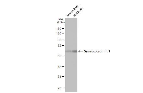 Western Blot: Synaptotagmin 1 Antibody (HL1626) - Azide and BSA Free [NBP3-25705] - Various tissue extracts (50 ug) were separated by 10% SDS-PAGE, and the membrane was blotted with Synaptotagmin 1 antibody [HL1626] (NBP3-25705) diluted at 1:20000. The HRP-conjugated anti-rabbit IgG antibody was used to detect the primary antibody.