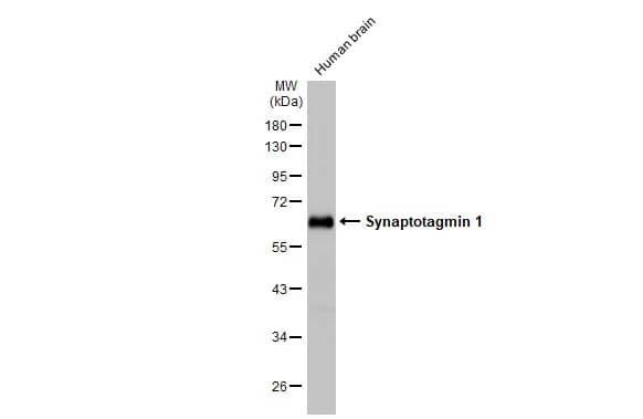 Western Blot: Synaptotagmin 1 Antibody (HL1626) - Azide and BSA Free [NBP3-25705] - Human tissue extract (5 ug) was separated by 10% SDS-PAGE, and the membrane was blotted with Synaptotagmin 1 antibody [HL1626] (NBP3-25705) diluted at 1:20000. The HRP-conjugated anti-rabbit IgG antibody was used to detect the primary antibody.