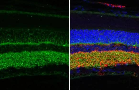 Synaptotagmin 1 antibody [HL1626] detects Synaptotagmin 1 protein at cell membrane and cytoplasm by immunohistochemical analysis.Sample: Paraffin-embedded rat eye.Synaptotagmin 1 stained by Synaptotagmin 1 antibody [HL1626] (NBP3-25705) diluted at 1:250.Red: beta Tubulin 3/ Tuj1, a neural marker, stained by beta Tubulin 3/ Tuj1 antibody [GT11710] diluted at 1:500.Blue: Fluoroshield with DAPI .Antigen Retrieval: Citrate buffer, pH 6.0, 15 min 