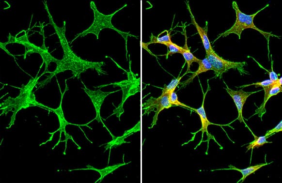Immunocytochemistry/Immunofluorescence: Synaptotagmin 1 Antibody (HL1654) - Azide and BSA Free [NBP3-25706] - Synaptotagmin 1 antibody [HL1654] detects Synaptotagmin 1 protein by immunofluorescent analysis. Sample: SH-SY-5Y cells were fixed in 4% paraformaldehyde at RT for 15 min. Green: Synaptotagmin 1 stained by Synaptotagmin 1 antibody [HL1654] (NBP3-25706) diluted at 1:500. Red: alpha Tubulin, a cytoskeleton marker, stained by alpha Tubulin antibody [GT114] (NBP2-43837) diluted at 1:1000. Blue: Fluoroshield with DAPI .