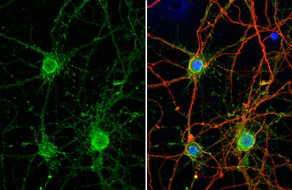Immunocytochemistry/Immunofluorescence: Synaptotagmin 1 Antibody (HL1654) - Azide and BSA Free [NBP3-25706] - Synaptotagmin 1 antibody [HL1654] detects Synaptotagmin 1 protein at cytoplasm by immunofluorescent analysis. Sample: DIV9 rat E18 primary hippocampal neuron cells were fixed in 4% paraformaldehyde at RT for 15 min. Green: Synaptotagmin 1 stained by Synaptotagmin 1 antibody [HL1654] (NBP3-25706) diluted at 1:250. Red: Tau, an axon marker, stained by Tau antibody [GT287] diluted at 1:500. Blue: Fluoroshield with DAPI .