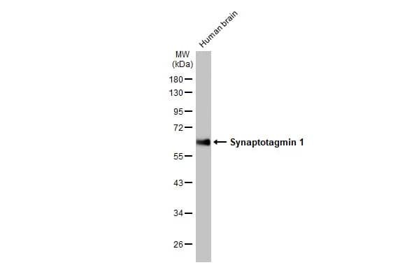 Western Blot: Synaptotagmin 1 Antibody (HL1654) - Azide and BSA Free [NBP3-25706] - Human tissue extract (5 ug) was separated by 10% SDS-PAGE, and the membrane was blotted with Synaptotagmin 1 antibody [HL1654] (NBP3-25706) diluted at 1:20000. The HRP-conjugated anti-rabbit IgG antibody was used to detect the primary antibody.