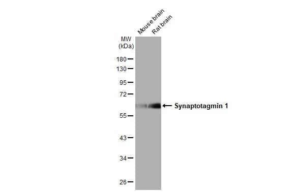 <b>Orthogonal Strategies Validation. </b>Western Blot: Synaptotagmin 1 Antibody (HL1654) - Azide and BSA Free [NBP3-25706] - Various tissue extracts (50 ug) were separated by 10% SDS-PAGE, and the membrane was blotted with Synaptotagmin 1 antibody [HL1654] (NBP3-25706) diluted at 1:20000. The HRP-conjugated anti-rabbit IgG antibody was used to detect the primary antibody.