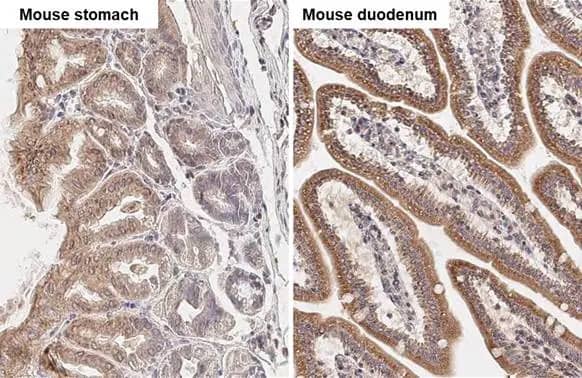 Immunohistochemistry-Paraffin: TBC1D5 Antibody (HL2054) - Azide and BSA Free [NBP3-25710] - TBC1D5 antibody [HL2054] detects TBC1D5 protein by immunohistochemical analysis. Sample: Paraffin-embedded mouse tissues. TBC1D5 stained by TBC1D5 antibody [HL2054] (NBP3-25710) diluted at 1:100. Antigen Retrieval: Citrate buffer, pH 6.0, 15 min