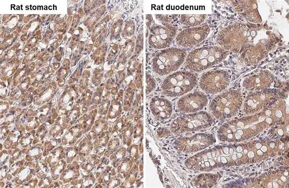 Immunohistochemistry-Paraffin: TBC1D5 Antibody (HL2054) - Azide and BSA Free [NBP3-25710] - TBC1D5 antibody [HL2054] detects TBC1D5 protein by immunohistochemical analysis. Sample: Paraffin-embedded rat tissues. TBC1D5 stained by TBC1D5 antibody [HL2054] (NBP3-25710) diluted at 1:100. Antigen Retrieval: Citrate buffer, pH 6.0, 15 min