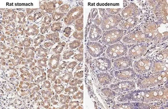 Immunohistochemistry-Paraffin: TBC1D5 Antibody (HL2390) - Azide and BSA Free [NBP3-25711] - TBC1D5 antibody [HL2390] detects TBC1D5 protein by immunohistochemical analysis. Sample: Paraffin-embedded rat tissues. TBC1D5 stained by TBC1D5 antibody [HL2390] (NBP3-25711) diluted at 1:100. Antigen Retrieval: Citrate buffer, pH 6.0, 15 min