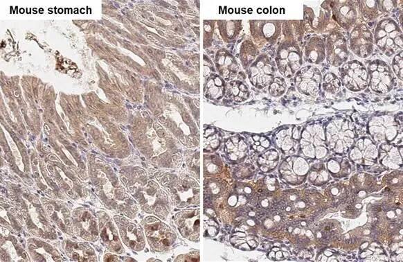 Immunohistochemistry-Paraffin: TBC1D5 Antibody (HL2390) - Azide and BSA Free [NBP3-25711] - TBC1D5 antibody [HL2390] detects TBC1D5 protein by immunohistochemical analysis. Sample: Paraffin-embedded mouse tissues. TBC1D5 stained by TBC1D5 antibody [HL2390] (NBP3-25711) diluted at 1:100. Antigen Retrieval: Citrate buffer, pH 6.0, 15 min