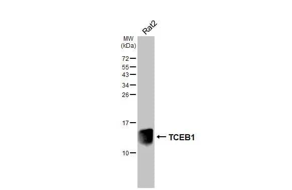 Whole cell extract (30 ug) was separated by 15% SDS-PAGE, and the membrane was blotted with TCEB1 antibody [HL1683] (NBP3-25712) diluted at 1:1000. The HRP-conjugated anti-rabbit IgG antibody was used to detect the primary antibody. 