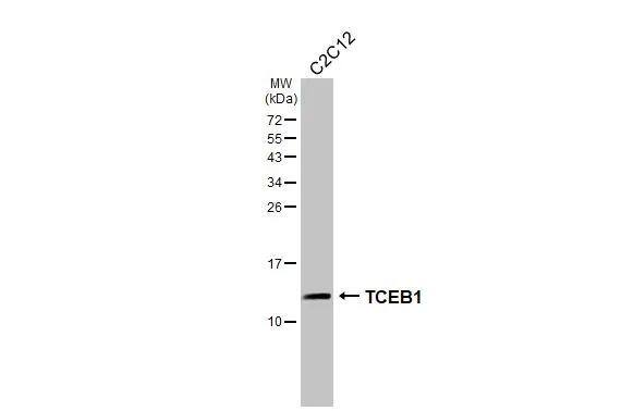 Whole cell extract (30 ug) was separated by 15% SDS-PAGE, and the membrane was blotted with TCEB1 antibody [HL1683] (NBP3-25712) diluted at 1:1000. The HRP-conjugated anti-rabbit IgG antibody was used to detect the primary antibody. 