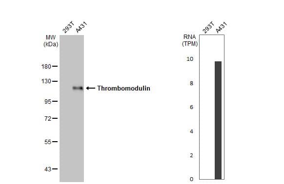 Western Blot: Thrombomodulin/BDCA-3 Antibody (HL1825) - Azide and BSA Free [NBP3-25718] - Various whole cell extracts (30 ug) were separated by 7.5% SDS-PAGE, and the membrane was blotted with Thrombomodulin antibody [HL1825] (NBP3-25718) diluted at 1:1000. The HRP-conjugated anti-rabbit IgG antibody was used to detect the primary antibody. Corresponding RNA expression data for the same cell lines are based on Human Protein Atlas program.