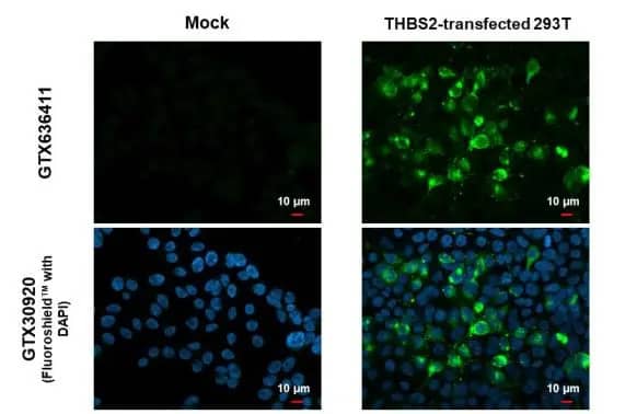 Immunocytochemistry/Immunofluorescence: Thrombospondin-2 Antibody (HL1140) - Azide and BSA Free [NBP3-25719] - Thrombospondin 2 antibody [HL1140] detects Thrombospondin 2 protein at cytoplasm by immunofluorescent analysis. Sample: Mock and transfected 293T cells were fixed in 4% paraformaldehyde at RT for 15 min. Green: Thrombospondin 2 stained by Thrombospondin 2 antibody [HL1140] (NBP3-25719) diluted at 1:500. Blue: Fluoroshield with DAPI .