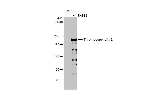 Western Blot: Thrombospondin-2 Antibody (HL1140) - Azide and BSA Free [NBP3-25719] - Non-transfected (-) and transfected (+) 293T whole cell extracts (30 ug) were separated by 5% SDS-PAGE, and the membrane was blotted with Thrombospondin 2 antibody [HL1140] (NBP3-25719) diluted at 1:300000. The HRP-conjugated anti-rabbit IgG antibody was used to detect the primary antibody.