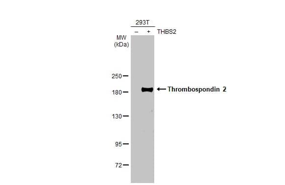 Western Blot: Thrombospondin-2 Antibody (HL1194) - Azide and BSA Free [NBP3-25720] - Non-transfected (-) and transfected (+) 293T whole cell extracts (30 ug) were separated by 5% SDS-PAGE, and the membrane was blotted with Thrombospondin 2 antibody [HL1194] (NBP3-25720) diluted at 1:5000. The HRP-conjugated anti-rabbit IgG antibody was used to detect the primary antibody.