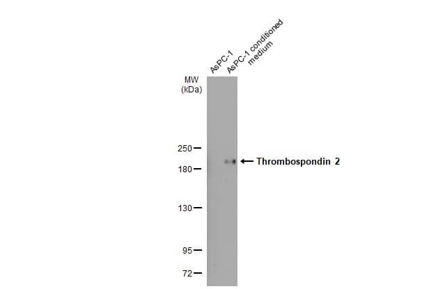 Western Blot: Thrombospondin-2 Antibody (HL1194) - Azide and BSA Free [NBP3-25720] - AsPC-1 whole cell extract and conditioned medium (30 ug) were separated by 5% SDS-PAGE, and the membrane was blotted with Thrombospondin 2 antibody [HL1194] (NBP3-25720) diluted at 1:1000. The HRP-conjugated anti-rabbit IgG antibody was used to detect the primary antibody.