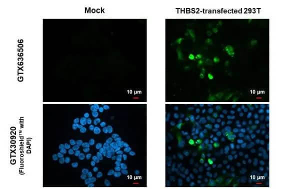 Immunocytochemistry/Immunofluorescence: Thrombospondin-2 Antibody (HL1194) - Azide and BSA Free [NBP3-25720] - Thrombospondin 2 antibody [HL1194] detects Thrombospondin 2 protein at cytoplasm by immunofluorescent analysis. Sample: Mock and transfected 293T cells were fixed in 4% paraformaldehyde at RT for 15 min. Green: Thrombospondin 2 stained by Thrombospondin 2 antibody [HL1194] (NBP3-25720) diluted at 1:500. Blue: Fluoroshield with DAPI .