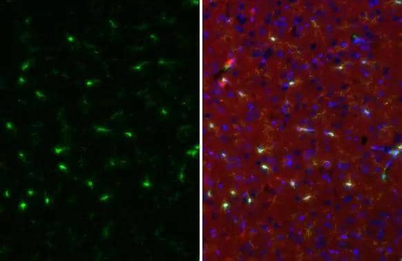 TMEM119 antibody [HL2415] detects TMEM119 protein by immunohistochemical analysis.Sample: Paraffin-embedded rat brain.Green: TMEM119 stained by TMEM119 antibody [HL2415] (NBP3-25724) diluted at 1:250.Red: Iba1, a cell membrane and cytoplasm marker, stained by Iba1 antibody [HL1880-MS] diluted at 1:250.Blue: Hoechst 33342 staining.Antigen Retrieval: Citrate buffer, pH 6.0, 15 min 