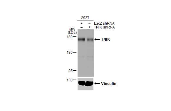 Western Blot: TNIK Antibody (HL1751) - Azide and BSA Free [NBP3-25725] - Non-transfected (-) and transfected (+) 293T whole cell extracts (30 ug) were separated by 5% SDS-PAGE, and the membrane was blotted with TNIK antibody [HL1751] (NBP3-25725) diluted at 1:10000. The HRP-conjugated anti-rabbit IgG antibody was used to detect the primary antibody, and the signal was developed with Trident ECL plus-Enhanced.