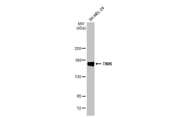 <b>Genetic Strategies Validation. </b>Western Blot: TNIK Antibody (HL1751) - Azide and BSA Free [NBP3-25725] - Whole cell extract (30 ug) was separated by 5% SDS-PAGE, and the membrane was blotted with TNIK antibody [HL1751] (NBP3-25725) diluted at 1:30000. The HRP-conjugated anti-rabbit IgG antibody was used to detect the primary antibody.