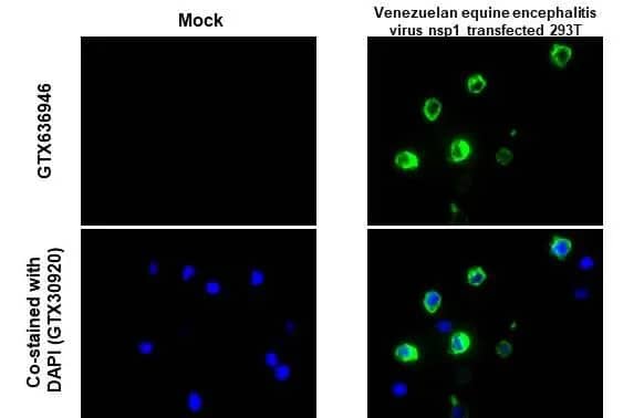 Immunohistochemistry-Paraffin: Venezuelan Equine Encephalitis Virus NSP1 Antibody (HL1472) - Azide and BSA Free [NBP3-25736] - Venezuelan equine encephalitis virus nsp1 antibody [HL1472] detects Venezuelan equine encephalitis virus nsp1 protein at cytoplasm by immunohistochemical analysis. Sample:Paraffin-embedded mock and Venezuelan equine encephalitis virus nsp1 transfected 293T cell pellet. Green: Venezuelan equine encephalitis virus nsp1 stained by Venezuelan equine encephalitis virus nsp1 antibody [HL1472] (NBP3-25736) diluted at 1:1000. Antigen Retrieval: Citrate buffer, pH 6.0, 15 min