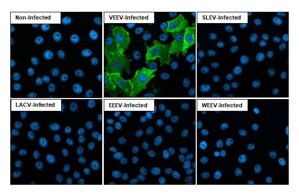 Immunocytochemistry/Immunofluorescence: Venezuelan Equine Encephalitis Virus NSP1 Antibody (HL1472) - Azide and BSA Free [NBP3-25736] - Immunofluorescent analysis of Venezuelan equine encephalitis virus infected cells using Venezuelan Equine Encephalitis Virus nsP1 antibody [HL1472] (NBP3-25736). Sample: Multiple virus infected cells slide. Green: Venezuelan Equine Encephalitis Virus nsP1 antibody [HL1472] (NBP3-25736) diluted at 1:100. Blue: Fluoroshield with DAPI .