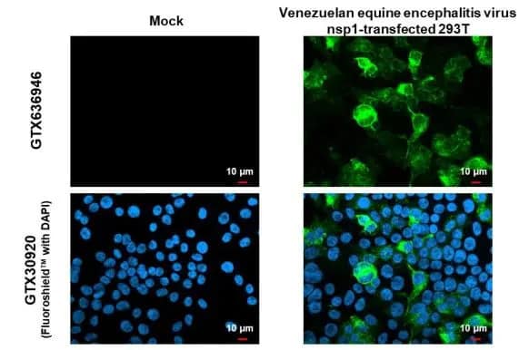 Immunocytochemistry/Immunofluorescence: Venezuelan Equine Encephalitis Virus NSP1 Antibody (HL1472) - Azide and BSA Free [NBP3-25736] - Venezuelan equine encephalitis virus nsp1 antibody [HL1472] detects Venezuelan equine encephalitis virus nsp1 protein by immunofluorescent analysis. Sample: Mock and transfected 293T cells were fixed in 4% paraformaldehyde at RT for 15 min. Green: Venezuelan equine encephalitis virus nsp1 stained by Venezuelan equine encephalitis virus nsp1 antibody [HL1472] (NBP3-25736) diluted at 1:500. Blue: Fluoroshield with DAPI .