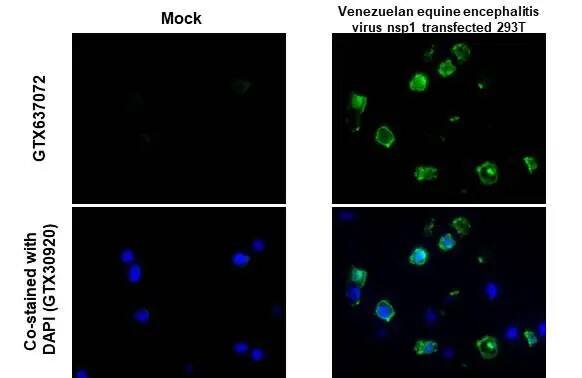 Immunohistochemistry-Paraffin: Venezuelan Equine Encephalitis Virus NSP1 Antibody (HL1593) - Azide and BSA Free [NBP3-25737] - Venezuelan equine encephalitis virus nsp1 antibody [HL1593] detects Venezuelan equine encephalitis virus nsp1 protein at cytoplasm by immunohistochemical analysis. Sample:Paraffin-embedded mock and Venezuelan equine encephalitis virus nsp1 transfected 293T cell pellet. Green: Venezuelan equine encephalitis virus nsp1 stained by Venezuelan equine encephalitis virus nsp1 antibody [HL1593] (NBP3-25737) diluted at 1:1000. Antigen Retrieval: Citrate buffer, pH 6.0, 15 min