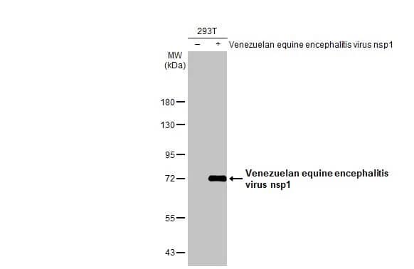 Western Blot: Venezuelan Equine Encephalitis Virus NSP1 Antibody (HL1593) - Azide and BSA Free [NBP3-25737] - Non-transfected (-) and transfected (+) 293T whole cell extracts (30 ug) were separated by 7.5% SDS-PAGE, and the membrane was blotted with Venezuelan equine encephalitis virus nsp1 antibody [HL1593] (NBP3-25737) diluted at 1:50000. The HRP-conjugated anti-rabbit IgG antibody was used to detect the primary antibody.