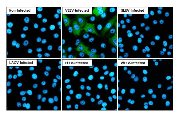 Immunocytochemistry/Immunofluorescence: Venezuelan Equine Encephalitis Virus NSP2 Antibody (HL1919) - Azide and BSA Free [NBP3-25738] - Immunofluorescent analysis of Venezuelan equine encephalitis virus infected cells using Venezuelan Equine Encephalitis Virus nsP2 antibody [HL1919] (NBP3-25738). Sample: Multiple virus infected cells slide. Green: Venezuelan Equine Encephalitis Virus nsP2 antibody [HL1919] (NBP3-25738) diluted at 1:100. Blue: Fluoroshield with DAPI .