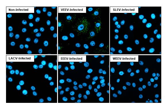 Immunocytochemistry/Immunofluorescence: Venezuelan Equine Encephalitis Virus NSP3 Antibody (HL1502) - Azide and BSA Free [NBP3-25739] - Immunofluorescent analysis of Venezuelan equine encephalitis virus infected cells using Venezuelan Equine Encephalitis Virus nsP3 antibody [HL1502] (NBP3-25739). Sample: Multiple virus infected cells slide. Green: Venezuelan Equine Encephalitis Virus nsP3 antibody [HL1502] (NBP3-25739) diluted at 1:100. Blue: Fluoroshield with DAPI .