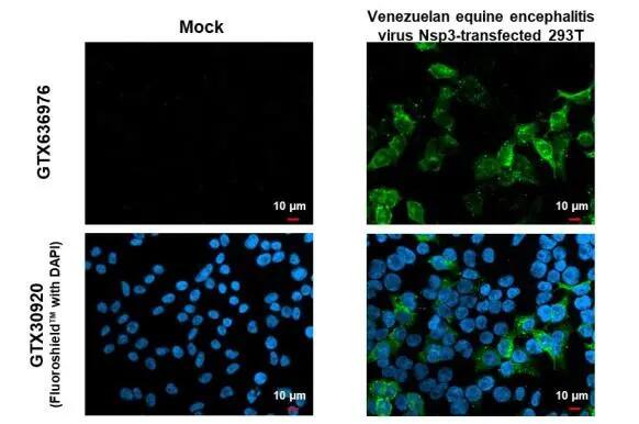 Immunocytochemistry/Immunofluorescence: Venezuelan Equine Encephalitis Virus NSP3 Antibody (HL1502) - Azide and BSA Free [NBP3-25739] - Venezuelan equine encephalitis virus nsp3 antibody [HL1502] detects Venezuelan equine encephalitis virus nsp3 protein by immunofluorescent analysis. Sample: Mock and transfected 293T cells were fixed in 4% paraformaldehyde at RT for 15 min. Green: Venezuelan equine encephalitis virus nsp3 stained by Venezuelan equine encephalitis virus nsp3 antibody [HL1502] (NBP3-25739) diluted at 1:500. Blue: Fluoroshield with DAPI .