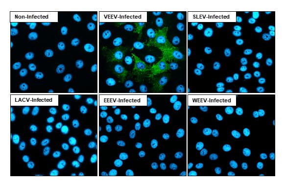 Immunocytochemistry/Immunofluorescence: Venezuelan Equine Encephalitis Virus NSP4 Antibody (HL1741) - Azide and BSA Free [NBP3-25741] - Immunofluorescent analysis of Venezuelan equine encephalitis virus infected cells using Venezuelan Equine Encephalitis Virus nsP4 antibody [HL1741] (NBP3-25741). Sample: Multiple virus infected cells slide. Green: Venezuelan Equine Encephalitis Virus nsP4 antibody [HL1741] (NBP3-25741) diluted at 1:100. Blue: Fluoroshield with DAPI .