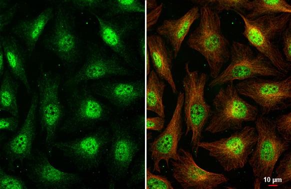 <b>Orthogonal Strategies Validation. </b>Immunocytochemistry/Immunofluorescence: Virilizer Antibody (HL1719) - Azide and BSA Free [NBP3-25744] - VIRMA antibody [HL1719] detects VIRMA protein at cytoplasm and nucleus by immunofluorescent analysis. Sample: HeLa cells were fixed in 4% paraformaldehyde at RT for 15 min. Green: VIRMA stained by VIRMA antibody [HL1719] (NBP3-25744) diluted at 1:500. Red: alpha Tubulin, a cytoskeleton marker, stained by alpha Tubulin antibody [GT114] diluted at 1:1000.