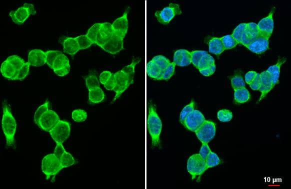 Wnt-10b antibody [HL2370] detects Wnt-10b protein at cell membrane by immunofluorescent analysis.Sample: HCT116 cells were fixed in 4% paraformaldehyde at RT for 15 min.Green: Wnt-10b stained by Wnt-10b antibody [HL2370] (NBP3-25749) diluted at 1:500.Blue: Fluoroshield with DAPI . 