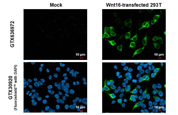 Immunocytochemistry/Immunofluorescence: Wnt16 Antibody (HL1498) - Azide and BSA Free [NBP3-25751] - Wnt16 antibody [HL1498] detects Wnt16 protein by immunofluorescent analysis. Sample: Mock and transfected 293T cells were fixed in 4% paraformaldehyde at RT for 15 min. Green: Wnt16 stained by Wnt16 antibody [HL1498] (NBP3-25751) diluted at 1:500. Blue: Fluoroshield with DAPI .