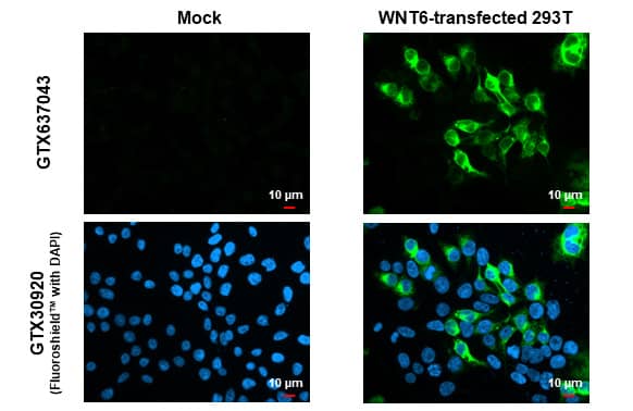 Immunocytochemistry/Immunofluorescence: Wnt-6 Antibody (HL1568) - Azide and BSA Free [NBP3-25754] - Wnt6 antibody [HL1568] detects Wnt6 protein by immunofluorescent analysis. Sample: Mock and transfected 293T cells were fixed in 4% paraformaldehyde at RT for 15 min. Green: Wnt6 stained by Wnt6 antibody [HL1568] (NBP3-25754) diluted at 1:500. Blue: Fluoroshield with DAPI .