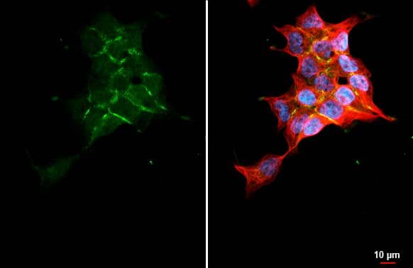 Wnt-9a antibody [HL2422] detects Wnt-9a protein by immunofluorescent analysis.Sample: T-47D cells were fixed in 4% paraformaldehyde at RT for 15 min.Green: Wnt-9a stained by Wnt-9a antibody [HL2422] (NBP3-25757) diluted at 1:500.Red: alpha Tubulin, a cytoskeleton marker, stained by alpha Tubulin antibody [GT114] diluted at 1:1000.Blue: Fluoroshield with DAPI . 