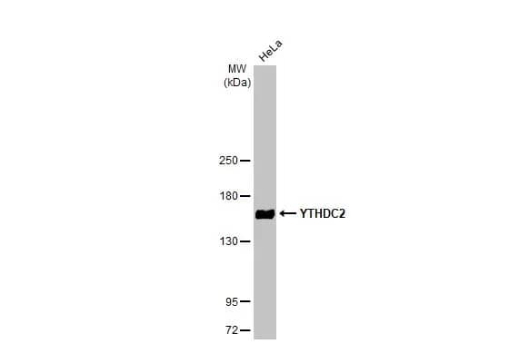 Western Blot: YTHDC2 Antibody (HL1861) - Azide and BSA Free [NBP3-25759] - Whole cell extract (30 ug) was separated by 5% SDS-PAGE, and the membrane was blotted with YTHDC2 antibody [HL1861] (NBP3-25759) diluted at 1:1000. The HRP-conjugated anti-rabbit IgG antibody was used to detect the primary antibody.