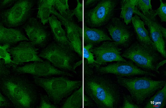 Immunocytochemistry/Immunofluorescence: YTHDC2 Antibody (HL1861) - Azide and BSA Free [NBP3-25759] - YTHDC2 antibody [HL1861] detects YTHDC2 protein at cytoplasm by immunofluorescent analysis. Sample: HeLa cells were fixed in 4% paraformaldehyde at RT for 15 min. Green: YTHDC2 stained by YTHDC2 antibody [HL1861] (NBP3-25759) diluted at 1:500. Blue: Fluoroshield with DAPI .