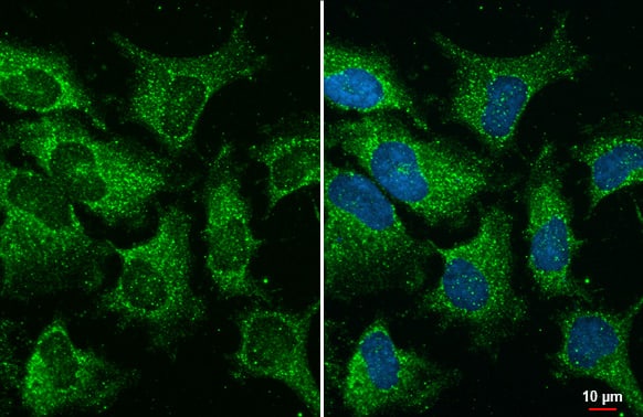 Immunocytochemistry/Immunofluorescence: YTHDC2 Antibody (HL1862) - Azide and BSA Free [NBP3-25760] - YTHDC2 antibody [HL1862] detects YTHDC2 protein at cytoplasm by immunofluorescent analysis. Sample: HeLa cells were fixed in ice-cold MeOH for 5 min. Green: YTHDC2 stained by YTHDC2 antibody [HL1862] (NBP3-25760) diluted at 1:200. Blue: Fluoroshield with DAPI .