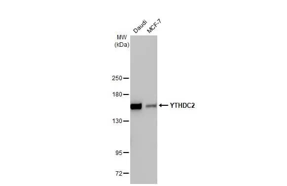 <b>Orthogonal Strategies Validation. </b>Western Blot: YTHDC2 Antibody (HL1862) - Azide and BSA Free [NBP3-25760] - Various whole cell extracts (30 ug) were separated by 5% SDS-PAGE, and the membrane was blotted with YTHDC2 antibody [HL1862] (NBP3-25760) diluted at 1:1000. The HRP-conjugated anti-rabbit IgG antibody was used to detect the primary antibody.